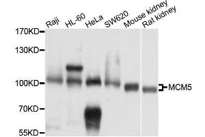 Western blot analysis of extracts of various cell lines, using MCM5 antibody. (MCM5 antibody  (AA 1-230))