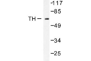Image no. 1 for anti-Tyrosine Hydroxylase (TH) antibody (ABIN271919) (Tyrosine Hydroxylase antibody)