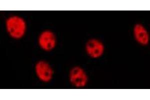 ABIN6275632 staining Hela by IF/ICC. (TOR1AIP1 antibody  (Internal Region))