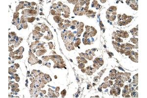 Alpha Actinin 2 antibody was used for immunohistochemistry at a concentration of 4-8 ug/ml to stain Skeletal muscle cells (arrows) in Human Muscle. (ACTN2 antibody  (C-Term))