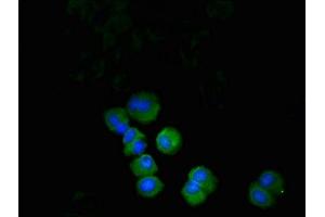 Immunofluorescent analysis of MCF-7 cells using ABIN7164683 at dilution of 1: 100 and Alexa Fluor 488-congugated AffiniPure Goat Anti-Rabbit IgG(H+L) (PD-1 antibody  (AA 21-170))