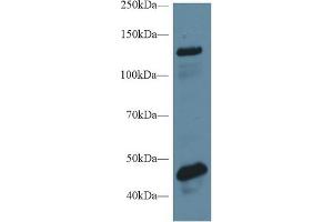 Detection of MGEA5 in Rat Cerebrum lysate using Polyclonal Antibody to Meningioma Expressed Antigen 5 (MGEA5) (MGEA5 antibody  (AA 6-240))