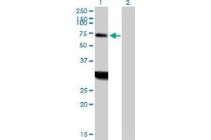 Western Blot analysis of ZNF238 expression in transfected 293T cell line by ZNF238 MaxPab polyclonal antibody. (ZNF238 antibody  (AA 1-522))