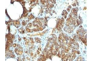 Formalin-fixed, paraffin-embedded human parathyroid stained with Parathyroid Hormone antibody (PTH/1173).