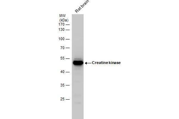 CKB antibody