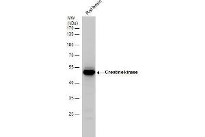 WB Image Creatine kinase (brain) antibody detects Creatine kinase protein by western blot analysis.