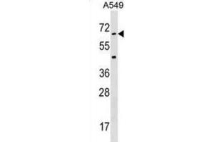 Western Blotting (WB) image for anti-Serine/threonine Kinase 35 (STK35) antibody (ABIN3003075) (STK35 antibody)