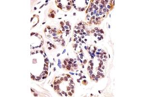 Immunohistochemical analysis of paraffin-embedded H. (T-Box 1 antibody  (C-Term))