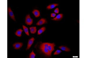 MCF-7 cells were stained with NFKB Polyclonal Antibody, Unconjugated at 1:500 in PBS and incubated for two hours at 37°C followed by Goat Anti-Rabbit IgG (H+L) Cy3 conjugated secondary antibody. (NFKB2 antibody  (AA 151-250))