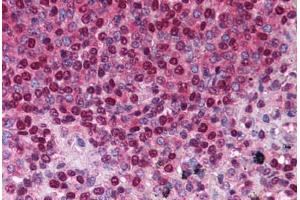 Spleen (TACI antibody  (AA 116-132))