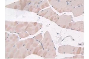 Figure. (Adiponectin Receptor 2 antibody  (AA 1-147))