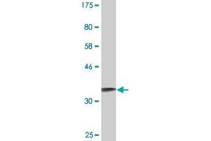 Western Blot detection against Immunogen (36. (S100A2 antibody  (AA 1-97))