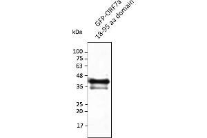 Western Blotting (WB) image for anti-SARS-CoV-2 ORF7a antibody (ABIN7272994) (SARS-CoV-2 ORF7a antibody)