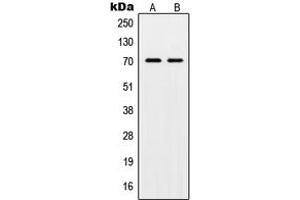 Western blot analysis of POT1 expression in HL60 (A), HeLa (B) whole cell lysates.
