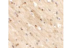 Immunohistochemistry of TMEM59L in mouse brain tissue with TMEM59L antibody at 2. (TMEM59L antibody  (C-Term))