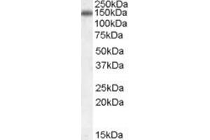 Western Blotting (WB) image for anti-Cartilage Intermediate Layer Protein, Nucleotide Pyrophosphohydrolase (CILP) (AA 858-870) antibody (ABIN290726)