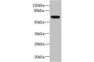 Western blot All lanes: ALCAMantibody IgG at 5. (CD166 antibody  (AA 28-180))