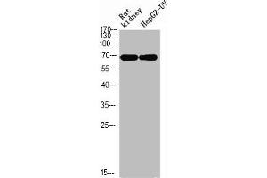 Western Blotting (WB) image for anti-X-Ray Repair Complementing Defective Repair in Chinese Hamster Cells 6 (XRCC6) (pSer5) antibody (ABIN7181841)