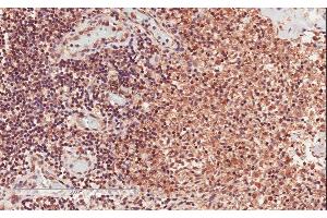 ABIN625822 (2µg/ml) staining of paraffin embedded Human Lymph Node. (CD28 antibody  (Internal Region))