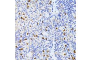 Immunohistochemistry of paraffin-embedded mouse spleen using SMAD2 antibody. (SMAD2 antibody  (AA 1-100))