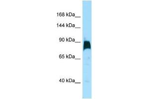 Western Blotting (WB) image for anti-Kinesin Family Member 7 (KIF7) (C-Term) antibody (ABIN2788987) (KIF7 antibody  (C-Term))