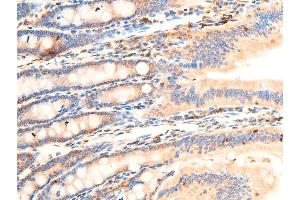 Immunohistochemistry (IHC) image for anti-Nuclear Factor of kappa Light Polypeptide Gene Enhancer in B-Cells Inhibitor, alpha (NFKBIA) (pSer32), (pSer36) antibody (ABIN6256292)