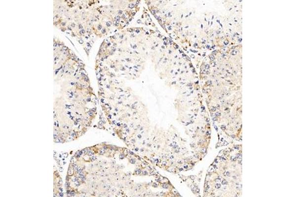 AZI2 antibody