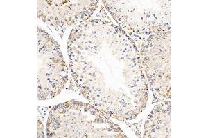 Immunohistochemistry of paraffin embedded mouse testis using AZI2 (ABIN7072856) at dilution of 1:650 (300x lens) (AZI2 antibody)