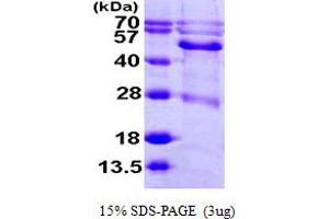 SDS-PAGE (SDS) image for Branched Chain Keto Acid Dehydrogenase E1, alpha Polypeptide (BCKDHA) (AA 46-445) protein (His tag) (ABIN667373)