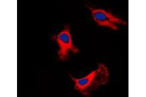Immunofluorescent analysis of Adenosine A2b Receptor staining in SHSY5Y cells. (Adenosine A2b Receptor antibody  (C-Term))