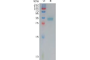 Claudin 3 Protein (CLDN3) (AA 144-156) (mFc Tag)