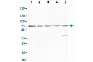 Western Blot analysis of Lane 1: HeLa, Lane 2: A-431, Lane 3: MCF-7, Lane 4: U2-OS and Lane 5: Hep-G2 cell lysates with FUS monoclonal antibody, clone CL0190 . (FUS antibody)