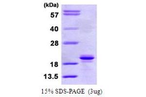 SDS-PAGE (SDS) image for Signaling threshold Regulating Transmembrane Adaptor 1 (SIT1) (AA 1-196) protein (His tag) (ABIN667557)