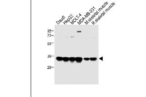 All lanes : Anti-LDHA Antibody (C-term) at 1:2000 dilution Lane 1: Daudi whole cell lysate Lane 2: HepG2 whole cell lysate Lane 3: MOLT-4 whole cell lysate Lane 4: MDA-MB-231 whole cell lysate Lane 5: Mouse skeletal muscle lysate Lane 6: Rat skeletal muscle lysate Lysates/proteins at 20 μg per lane. (Lactate Dehydrogenase A antibody  (C-Term))