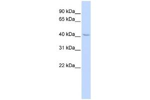WB Suggested Anti-ZNF174 Antibody Titration: 0.
