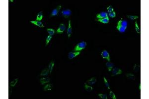 Immunofluorescence staining of Hela cells with ABIN7171365 at 1:166, counter-stained with DAPI. (CD2 antibody  (AA 25-209))