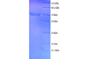 RPS18 Protein (AA 2-152, full length) (GST tag)