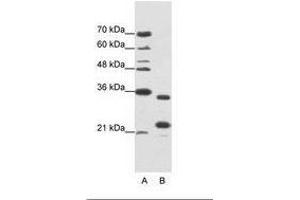 Image no. 1 for anti-AlkB, Alkylation Repair Homolog 8 (ALKBH8) (AA 141-190) antibody (ABIN1099945) (ALKBH8 antibody  (AA 141-190))