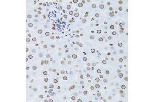 Immunohistochemistry (Paraffin-embedded Sections) (IHC (p)) image for anti-Nuclear Factor of kappa Light Polypeptide Gene Enhancer in B-Cells 2 (NFKB2) (AA 690-899) antibody (ABIN3017388)
