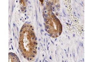 ABIN6266929 at 1/100 staining human Prostate tissue sections by IHC-P. (Anoctamin 7 antibody  (Internal Region))