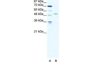 Western Blotting (WB) image for anti-Interferon Regulatory Factor 5 (IRF5) antibody (ABIN2461651) (IRF5 antibody)
