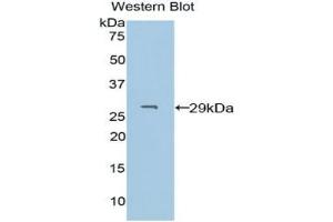Detection of Recombinant PDXK, Human using Polyclonal Antibody to Pyridoxal Kinase (PDXK) (PDXK antibody  (AA 29-253))