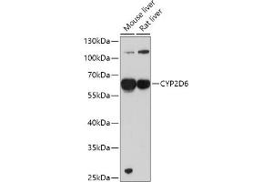 Western blot analysis of extracts of various cell lines, using CYP2D6 antibody (ABIN1512811, ABIN3021880, ABIN3021882 and ABIN6216807) at 1:1000 dilution. (CYP2D6 antibody  (AA 20-230))
