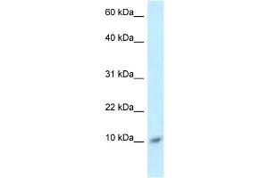 WB Suggested Anti-S100A8 Antibody Titration: 1. (S100A8 antibody  (Middle Region))
