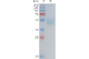 SDS-PAGE (SDS) image for Thymic Stromal Lymphopoietin (TSLP) (AA 20-140) protein (Fc Tag) (ABIN7538549)
