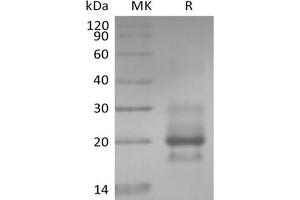 Western Blotting (WB) image for Tumor Necrosis Factor Receptor Superfamily, Member 10a (TNFRSF10A) protein (His tag) (ABIN7319898)