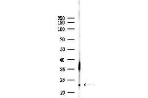 anti-Glycoprotein Hormones, alpha Polypeptide (CGA) (Internal Region) antibody
