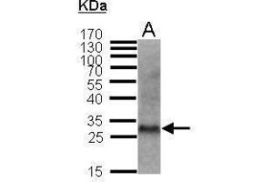 WB Image Sample (50 ug of whole cell lysate) A: MFB (mouse fibroblast) 12% SDS PAGE antibody diluted at 1:1000 (CDKN1B antibody)