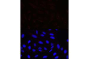 Immunofluorescence analysis of U-2 OS cells using PCNT Rabbit pAb (ABIN7269216) at dilution of 1:100 (40x lens). (PCNT antibody)