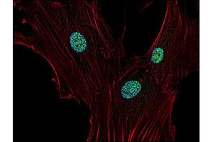 Immunocytochemistry (ICC) image for anti-Cyclin-Dependent Kinase Inhibitor 1A (p21, Cip1) (CDKN1A) antibody (ABIN94444)